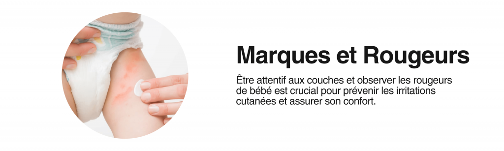 olamuchachas banniere article section marques et rougeurs